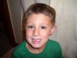 jacks_lost_tooth.jpg